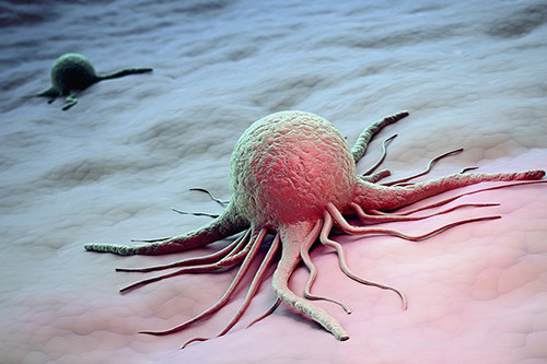 20130722-a-daganatok-fizikaja-rakos-sejt-illusztracio.jpg