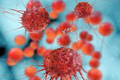 breast-cancer-cells_0.jpg
